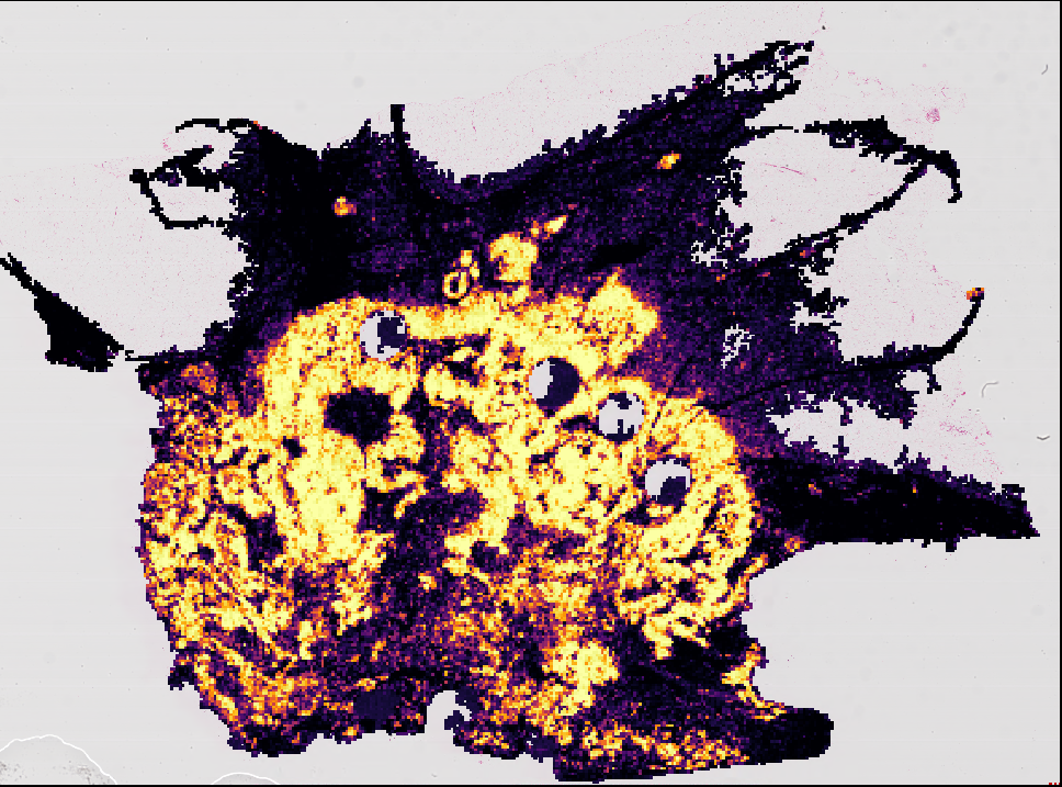 brca-heatmap.png