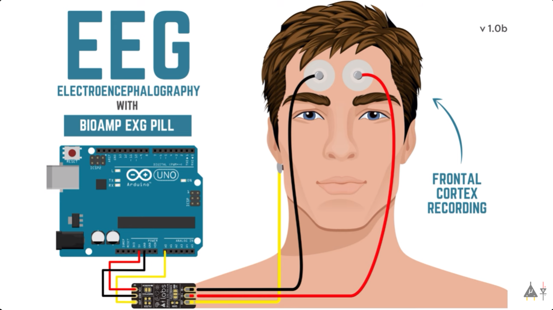 eeg-image.png