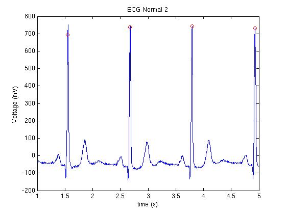 ECG2_derivative.jpg