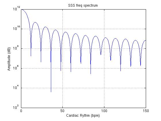 ecg_SSS_freq_spectrum_bpm.jpg