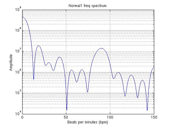 ecg_normal1_freq_spectrum_bpm.jpg