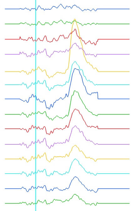 Epoched Data