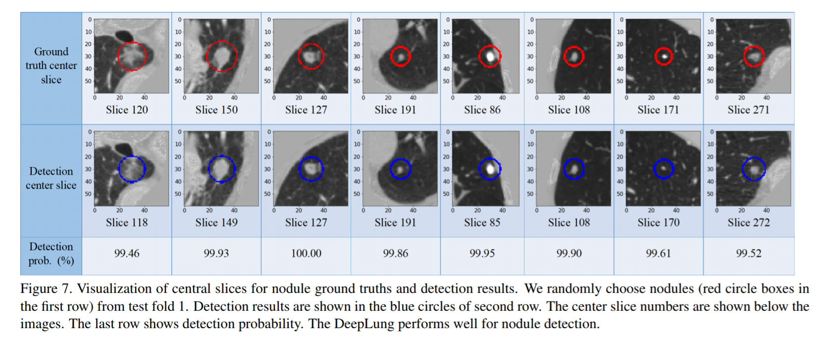 DeepLung-fig7.png